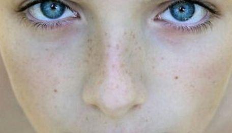 【2023年北京哪家醫(yī)院看胎痣好？專家推薦】