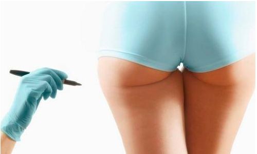 成都吸脂手術(shù)這些醫(yī)院值得你關(guān)注！五家頂尖整形醫(yī)院實(shí)力盤點(diǎn)