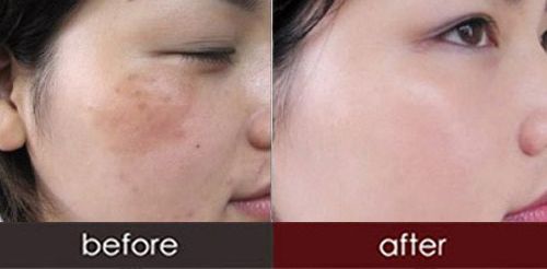 南京注射瘦臉針哪家好？2023南京市最佳瘦臉針醫(yī)療機(jī)構(gòu)推薦