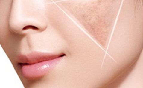 上海注射瘦臉針哪家醫(yī)院技術(shù)最專業(yè)？