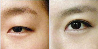 臨沂哪家醫(yī)院祛疤痕好？細(xì)致評測，為您推薦臨沂專業(yè)祛疤痕醫(yī)院！