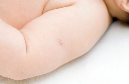 貴陽鼻子整形哪家醫(yī)院好？選擇合適的整形醫(yī)院才能安心整形！