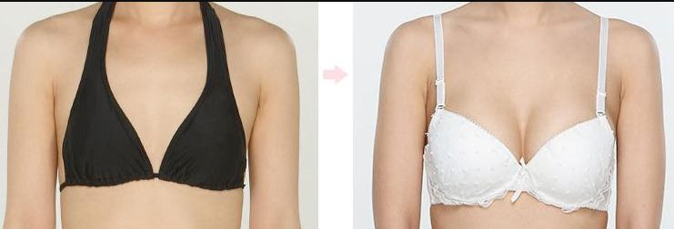 【2023上海哪家醫(yī)院去除巴好？全面解析上海頂尖去除巴醫(yī)療機構】