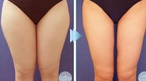 武漢雙眼皮手術(shù)醫(yī)院哪家好？綜合評價與價格公開！