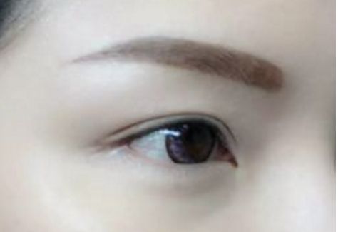 南充私立整形醫(yī)院2023年全面揭秘，錯(cuò)過(guò)可惜！