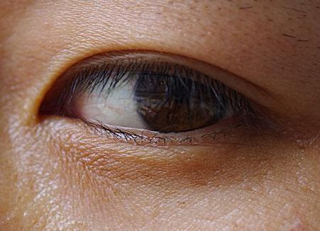 鄭元暢整容了嗎？揭秘明星整容風(fēng)潮中的真相！