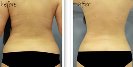 無錫去胎痣醫(yī)院哪家好？專業(yè)推薦無錫哪家醫(yī)院去胎痣好