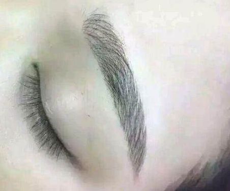 ?？谟心男I(yè)治療疤痕的醫(yī)院？海口看疤痕醫(yī)院哪家效果最好？