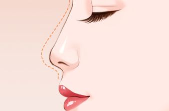 大理哪里做雙眼皮效果好？大理做雙眼皮的醫(yī)院推薦