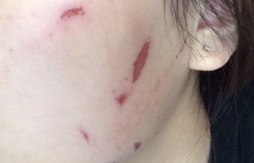 南昌哪家醫(yī)院能夠最佳完成鼻子整形手術(shù)？選擇集結(jié)，8所醫(yī)院聚焦技術(shù)與風(fēng)格展現(xiàn)！