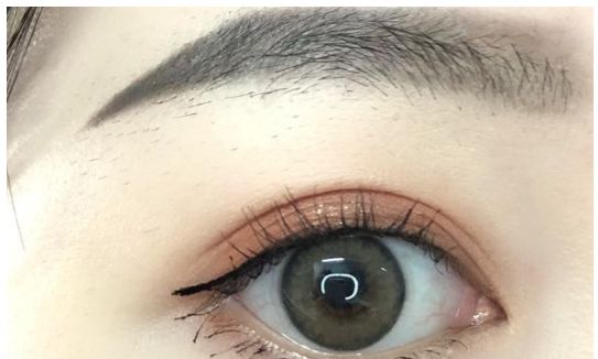 推薦：深圳有哪些值得信賴的整容醫(yī)院？名氣大，口碑好！