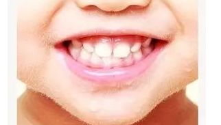 2023年上海雙眼皮技術(shù)翹楚醫(yī)生名單整理！