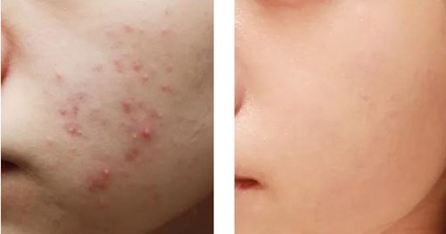 赤木晴子如何展現(xiàn)自己的獨(dú)特魅力？