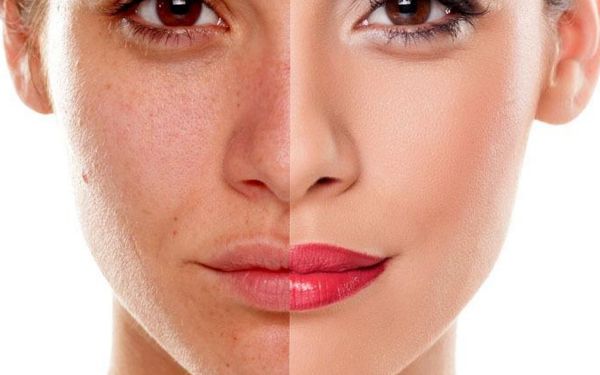 福州韓式整容醫(yī)院哪家好？探尋福州市備受好評的韓國整容醫(yī)院！