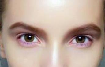 李沁整容前后變化是事實(shí)嗎？明星整容有哪些影響？