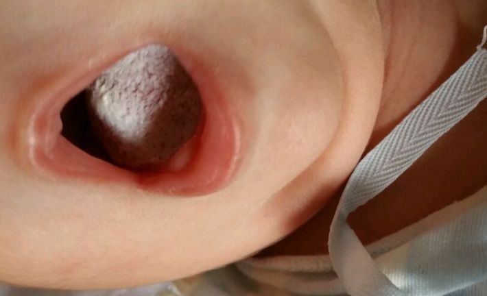 天津陰唇整形醫(yī)院哪家好？揭秘天津地區(qū)專業(yè)陰唇整形醫(yī)院排行榜！