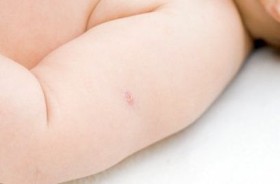 郝蕾整容風(fēng)波揭開了明星整容的另一面