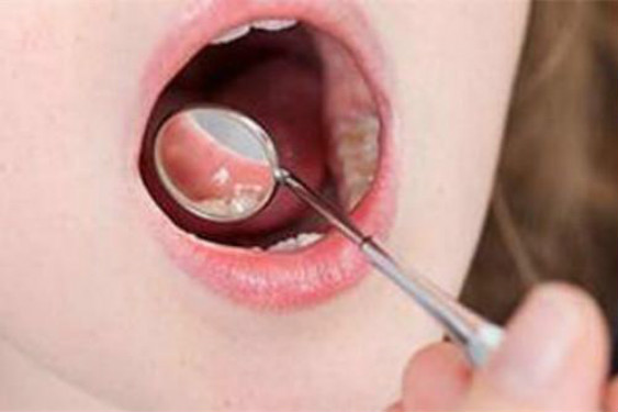 鄭州植發(fā)醫(yī)院TOP名單全國連鎖，技術和效果是否更注重？價格是否親民？