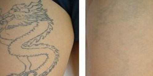 郭敬明是否通過整容改變了形象？