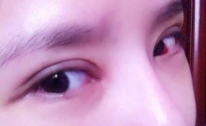 獨(dú)家！沈陽(yáng)祛除木偶紋比較好的整形醫(yī)院排行榜2023年最新發(fā)布