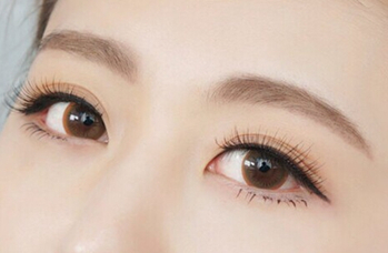 激光去黑眼圈手術費用計算方式是怎樣的？術后需要注意哪些事項呢？