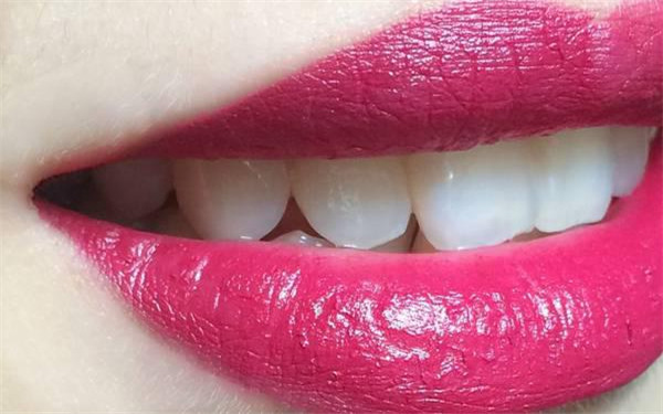 廣州哪家整形美容醫(yī)院做鼻子墊假體手術(shù)好？2023年美容醫(yī)院TOP10評分超高，技術(shù)流派強(qiáng)勢！