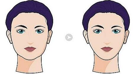 鼻翼收縮術(shù)的效果能維持多久？有風(fēng)險(xiǎn)嗎？