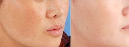 西寧整形好醫(yī)院排名及特色解析，你知道哪家醫(yī)院最靠譜嗎？