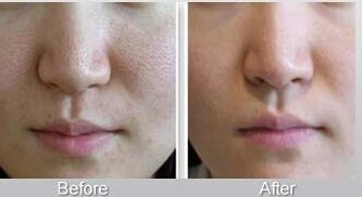 長沙整形美容哪家醫(yī)院好，安全可靠的專家推薦！