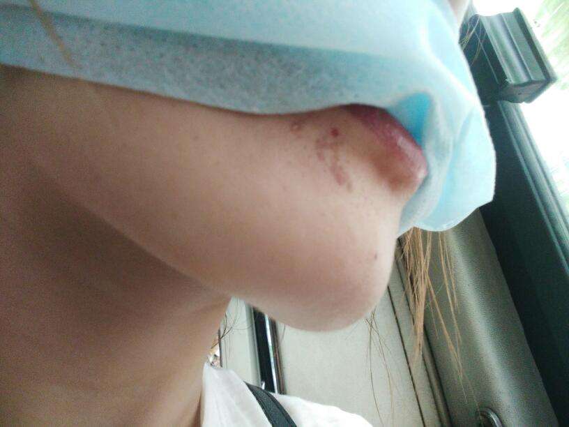 立體動(dòng)態(tài)吸脂真的適合各種狀況嗎？立體動(dòng)態(tài)吸脂的優(yōu)勢(shì)何在？