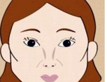 “全身抽脂手術(shù)是什么？它有哪些基本常識(shí)？”