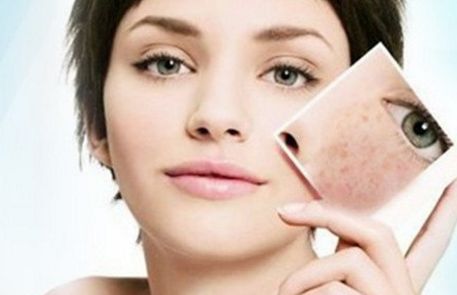 昆明去痘坑哪家醫(yī)院專業(yè)好？