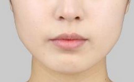 2023深圳吸脂塑身醫(yī)院排行榜前十強，哪家技術(shù)比較靠譜？