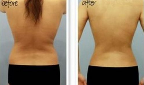 南京專業(yè)祛斑哪家醫(yī)院好？選擇南京哪家醫(yī)院祛斑效果好？