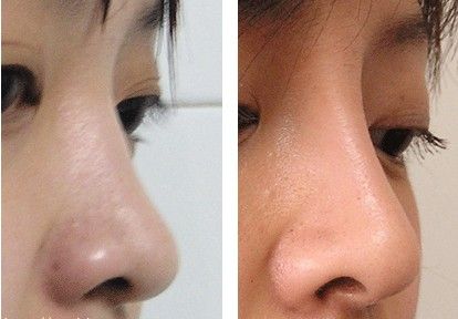 上海哪家醫(yī)院黑眼圈效果好？排名最好的專業(yè)醫(yī)院有哪些？