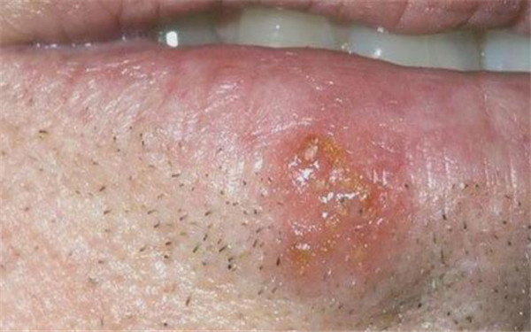 南方醫(yī)科大學(xué)珠江醫(yī)院整形外科手術(shù)費(fèi)用如何？手術(shù)項(xiàng)目有哪些？