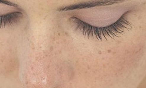 全國(guó)哪家醫(yī)院的偏頜整形效果好？如何選擇最適合自己的醫(yī)院呢？