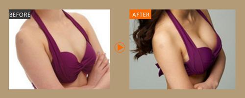 2023成都比較靠譜的激光祛除眼底紋醫(yī)療美容醫(yī)院推薦！排名榜前十等你來選擇！