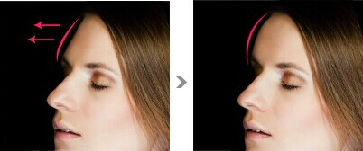 2023年沈陽(yáng)哪家醫(yī)院做面部除皺整形比較好？沈陽(yáng)面部除皺術(shù)醫(yī)療整形醫(yī)院top10強(qiáng)排名公布！