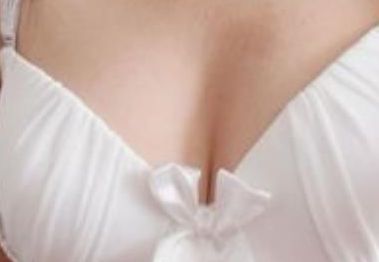 北京哪家醫(yī)院看減肥效果好？