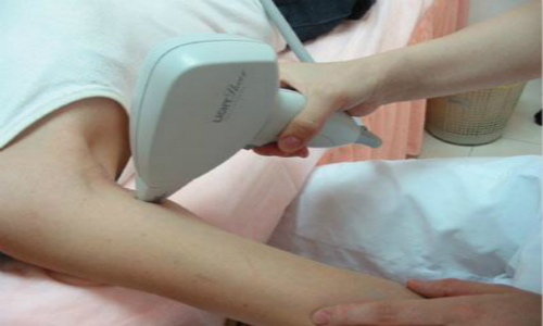 下頜角寬大有哪些類型？劈外板與下頜角手術有何不同之處？