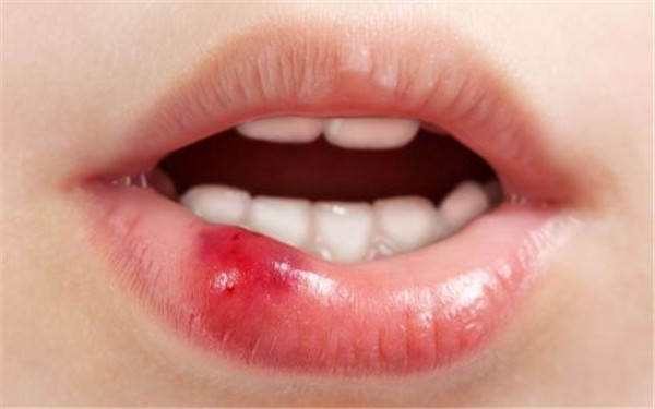 滁州市第一人民醫(yī)院整形科真的有不后悔的吸脂案例和價格嗎？