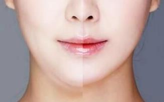 青島艾美整形美容醫(yī)院的醫(yī)生是否正規(guī)？整形手術(shù)價格表如何展示？