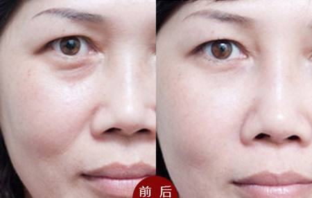 成都德康醫(yī)院，你值得信賴嗎？保證你的醫(yī)美整形安全嗎？