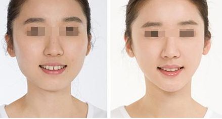 廣州做私密手術(shù)哪家醫(yī)院好，選擇哪家醫(yī)院最合適