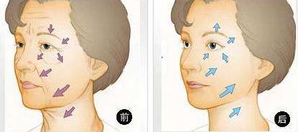 全球領(lǐng)先植發(fā)醫(yī)院盛傳！2023獨家揭曉！雍禾、新生等傲視同行！