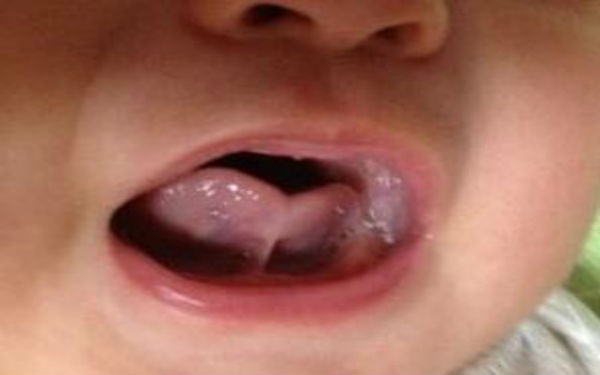 2023中國(guó)切除祛川字紋排名前十強(qiáng)整形美容醫(yī)院曝光！這些醫(yī)院的整形效果讓你驚艷躍然紙上！