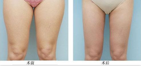 成都眼部美容哪家好且價(jià)格公正實(shí)惠？