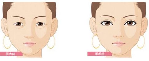 為何云南華美美萊整形第六屆國(guó)際整形節(jié)爆品引爆眼球？