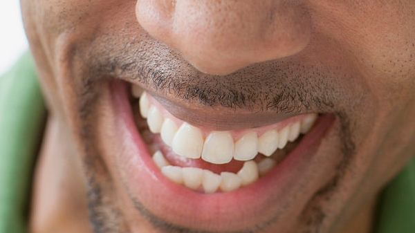 M型輕量級植發(fā)真的可以解決型男脫發(fā)問題嗎？如何實現(xiàn)持久性成果？